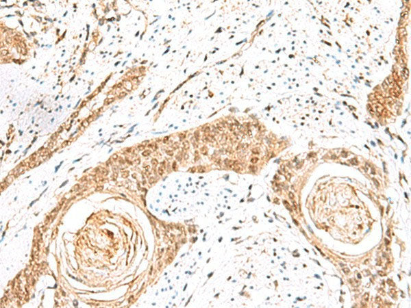 ELF3 Polyclonal Antibody Reactivity Human