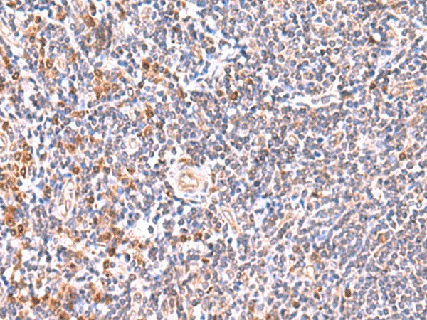GMDS Polyclonal Antibody Reactivity Human