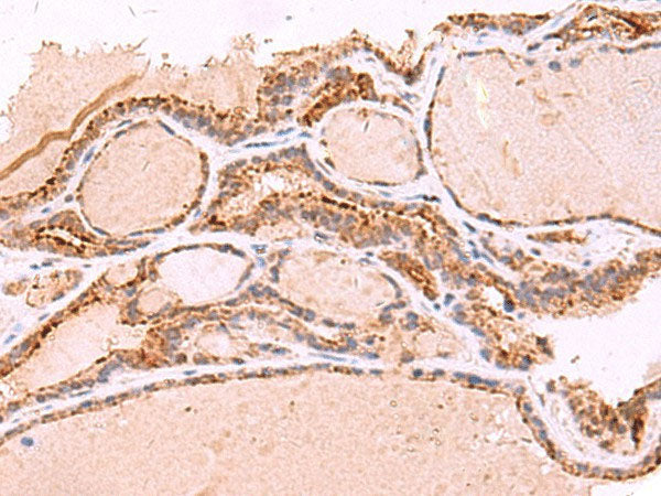 RABEPK Polyclonal Antibody Reactivity Human