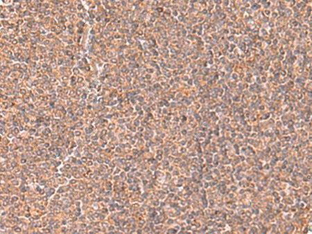 RABEPK Polyclonal Antibody Reactivity Human