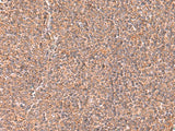 RABEPK Polyclonal Antibody Reactivity Human