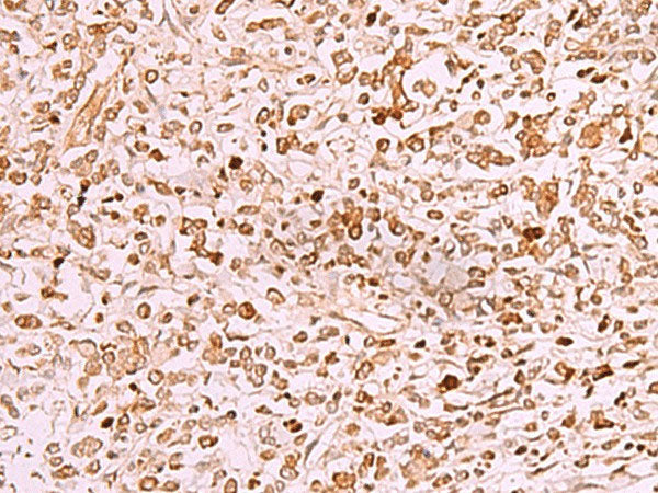 SAMSN1 Polyclonal Antibody Reactivity Human