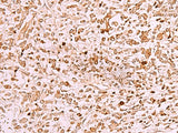 SAMSN1 Polyclonal Antibody Reactivity Human