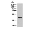 SAMSN1 Polyclonal Antibody Reactivity Human