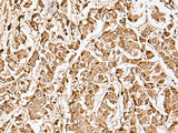 MECR Polyclonal Antibody Reactivity Human