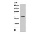 MECR Polyclonal Antibody Reactivity Human
