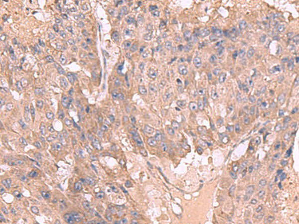 MAGEC2 Polyclonal Antibody Reactivity Human