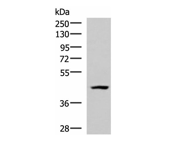 MAGEC2 Polyclonal Antibody Reactivity Human