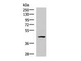 MAGEC2 Polyclonal Antibody Reactivity Human