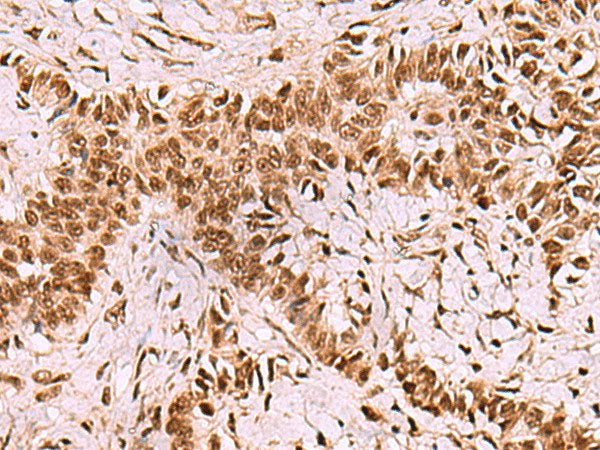 LDB1 Polyclonal Antibody Reactivity Human