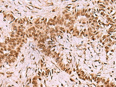 LDB1 Polyclonal Antibody Reactivity Human