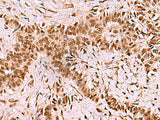 LDB1 Polyclonal Antibody Reactivity Human