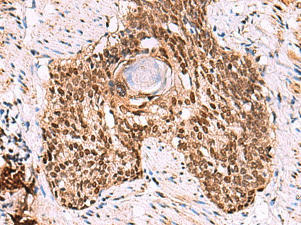 LDB1 Polyclonal Antibody Reactivity Human