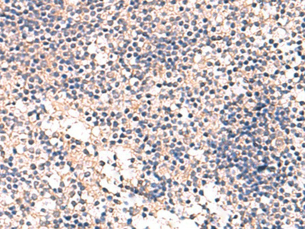 MKS1 Polyclonal Antibody Reactivity Human