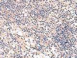 MKS1 Polyclonal Antibody Reactivity Human