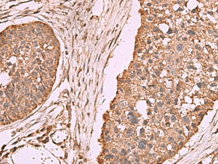 PER3 Polyclonal Antibody Reactivity Human