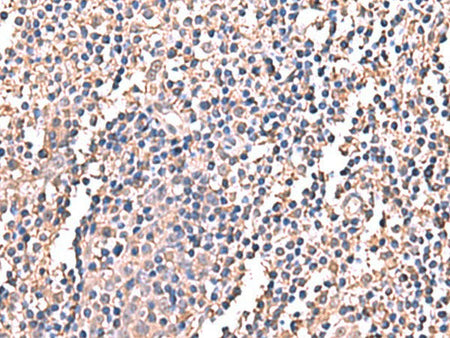 LDHAL6B Polyclonal Antibody Reactivity Human