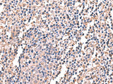 LDHAL6B Polyclonal Antibody Reactivity Human