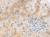 RNF13 Polyclonal Antibody Reactivity Human