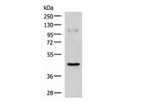 RAB3IL1 Polyclonal Antibody Reactivity Human