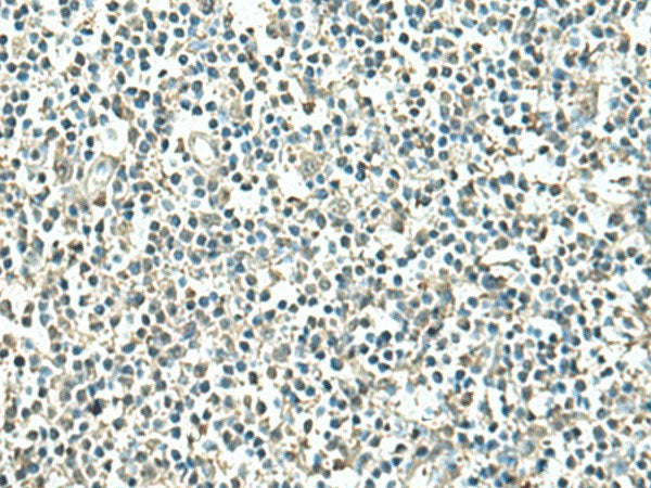 ATP6V1C1 Polyclonal Antibody Reactivity Human