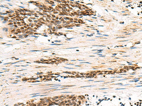 GABPB1 Polyclonal Antibody Reactivity Human