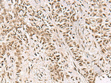 GABPB1 Polyclonal Antibody Reactivity Human