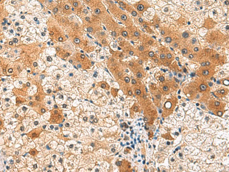 PCYT2 Polyclonal Antibody Reactivity Human