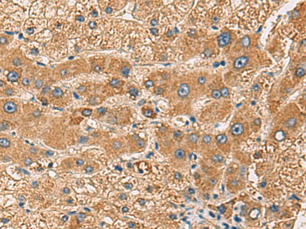PDHA1 Polyclonal Antibody Reactivity Human