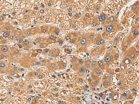 PDHA1 Polyclonal Antibody Reactivity Human