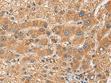 PDHA1 Polyclonal Antibody Reactivity Human