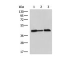 PDHA1 Polyclonal Antibody Reactivity Human