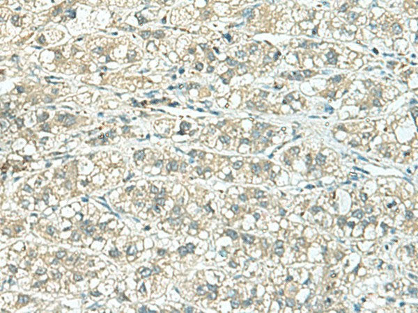 TENT5C Polyclonal Antibody Reactivity Human