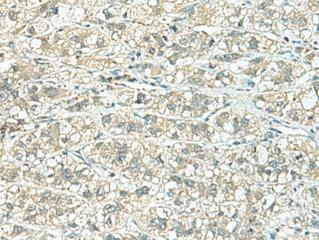 TENT5C Polyclonal Antibody Reactivity Human