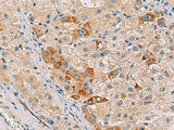 RMDN2 Polyclonal Antibody Reactivity Human