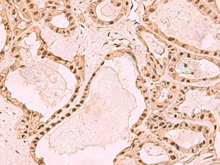 SETDB1 Polyclonal Antibody