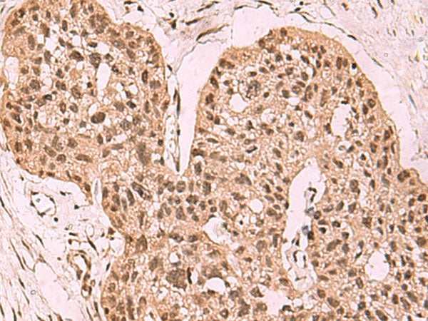 SETDB1 Polyclonal Antibody