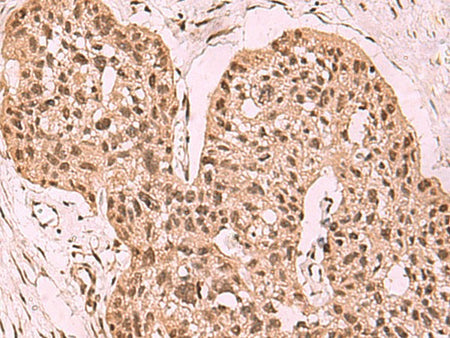 SETDB1 Polyclonal Antibody