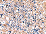 LIPA Polyclonal Antibody Reactivity Human