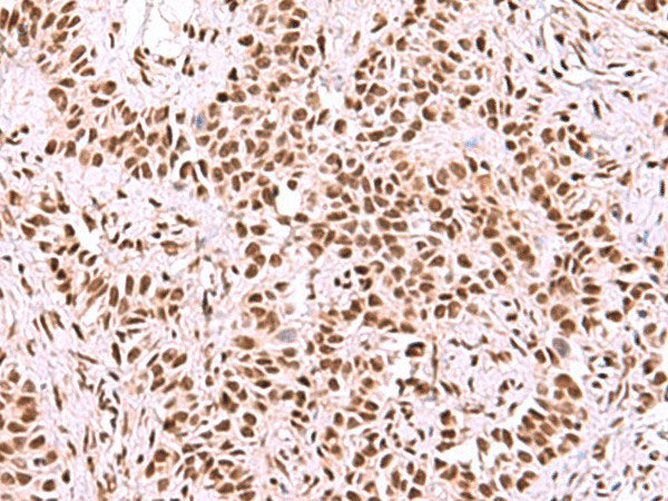 SF3B3 Polyclonal Antibody Reactivity Human