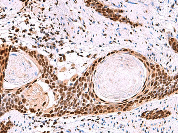 SF3B3 Polyclonal Antibody Reactivity Human