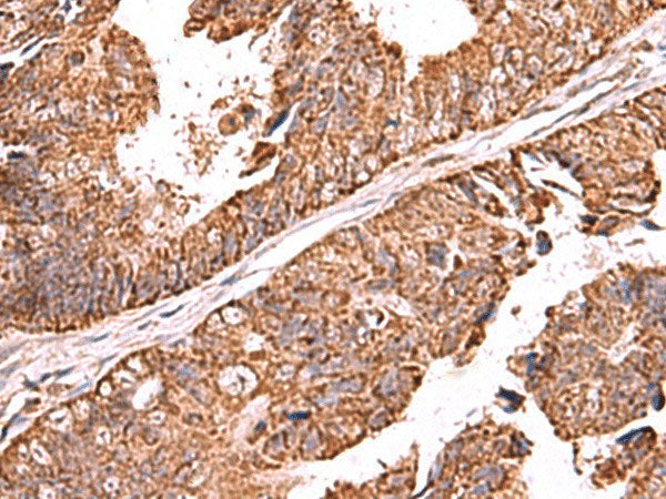 UBAC1 Polyclonal Antibody Reactivity Human