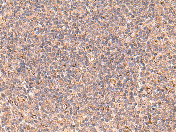 UBAC1 Polyclonal Antibody Reactivity Human