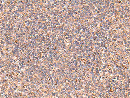 UBAC1 Polyclonal Antibody Reactivity Human