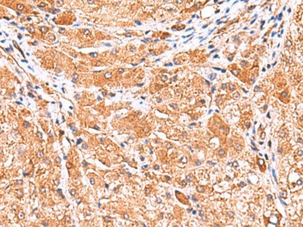 PHKG2 Polyclonal Antibody Reactivity Human