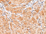 PHKG2 Polyclonal Antibody Reactivity Human