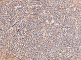 PHKG2 Polyclonal Antibody Reactivity Human