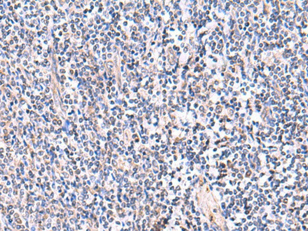 FDFT1 Polyclonal Antibody Reactivity Human