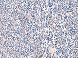 FDFT1 Polyclonal Antibody Reactivity Human