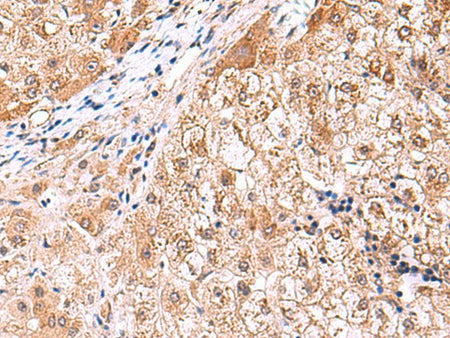 FDFT1 Polyclonal Antibody Reactivity Human